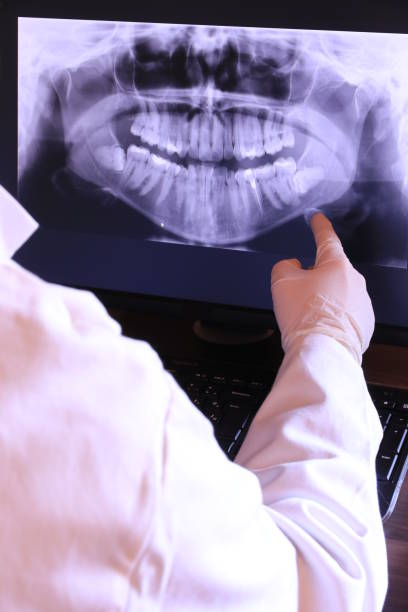 Best Emergency Wisdom Tooth Extraction in Wilton Center, CT